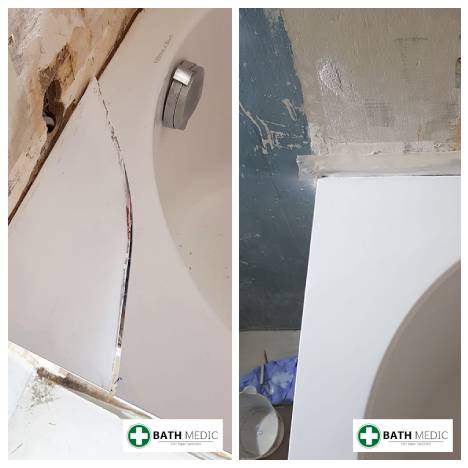 Bath chip repair Birmingham — Bath Medic