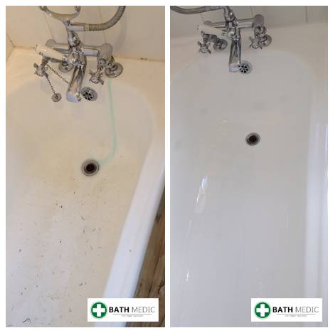 Hilton Hotel Birmingham bath re-enamelling — Bath Medic